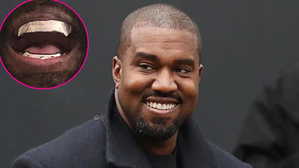 Kanye West Shows Off 850000 Titanium Grill Inspired by James Bond Villain Feature